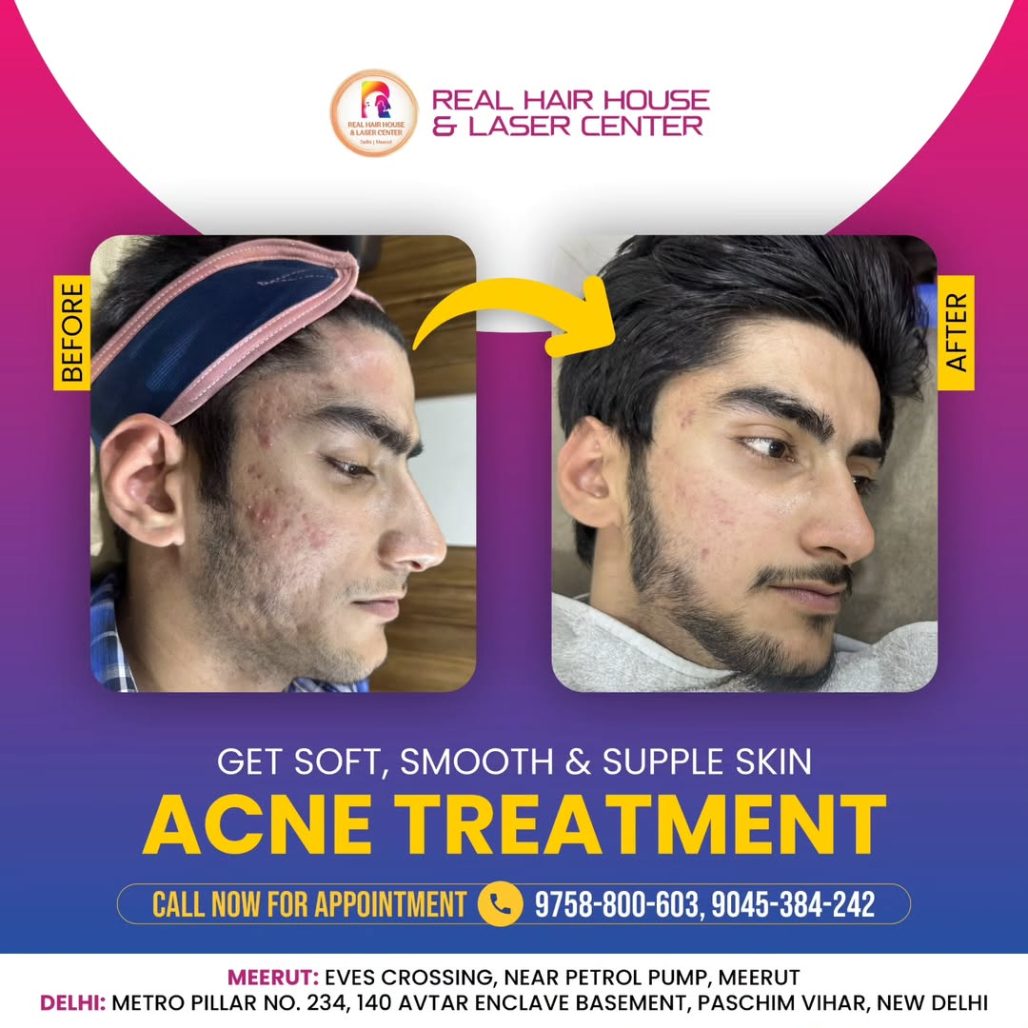 Beautiful skin starts here. 📞 Need info Call us at 9536-384-242 or 9045-384-242! 🌟📍 Delhi- D